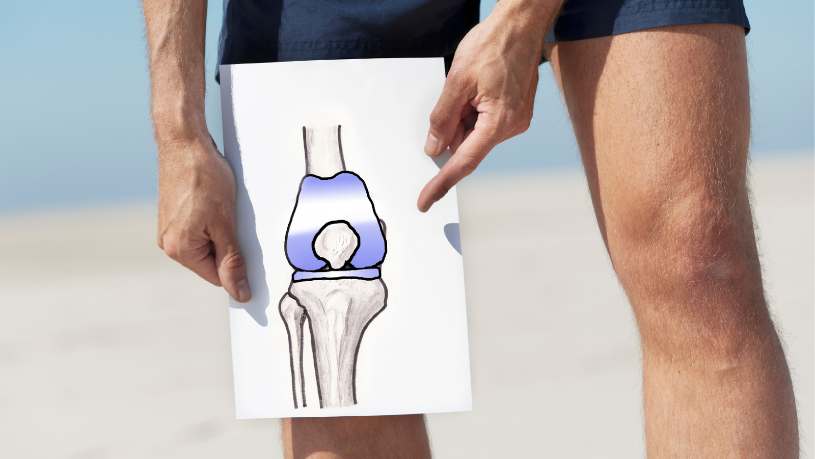 Here’s What You Need to Know About Total Knee Replacements OneStep